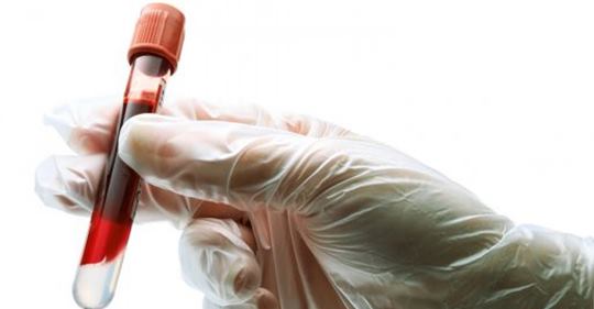 Медики дослідили, люди з якою групою крові найбільш схильні до коронавірусую…