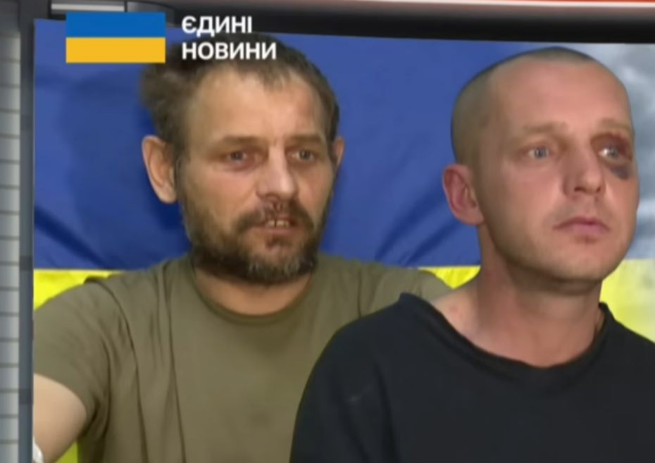 ТАКОГО ЩЕ НЕ ЧУЛИ. Полонений з ТАКИМ ДІАГНОЗОМ вперше потрапив до рук ЗСУ. Просто послухайте, що говорить…